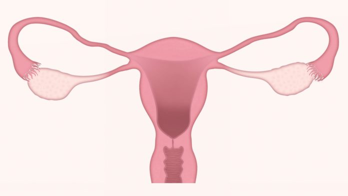 Cáncer de cuello uterino